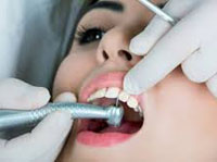 Lecenje bolesti usta i zuba
