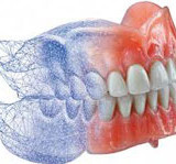 Totalna i parcijalna proteza
